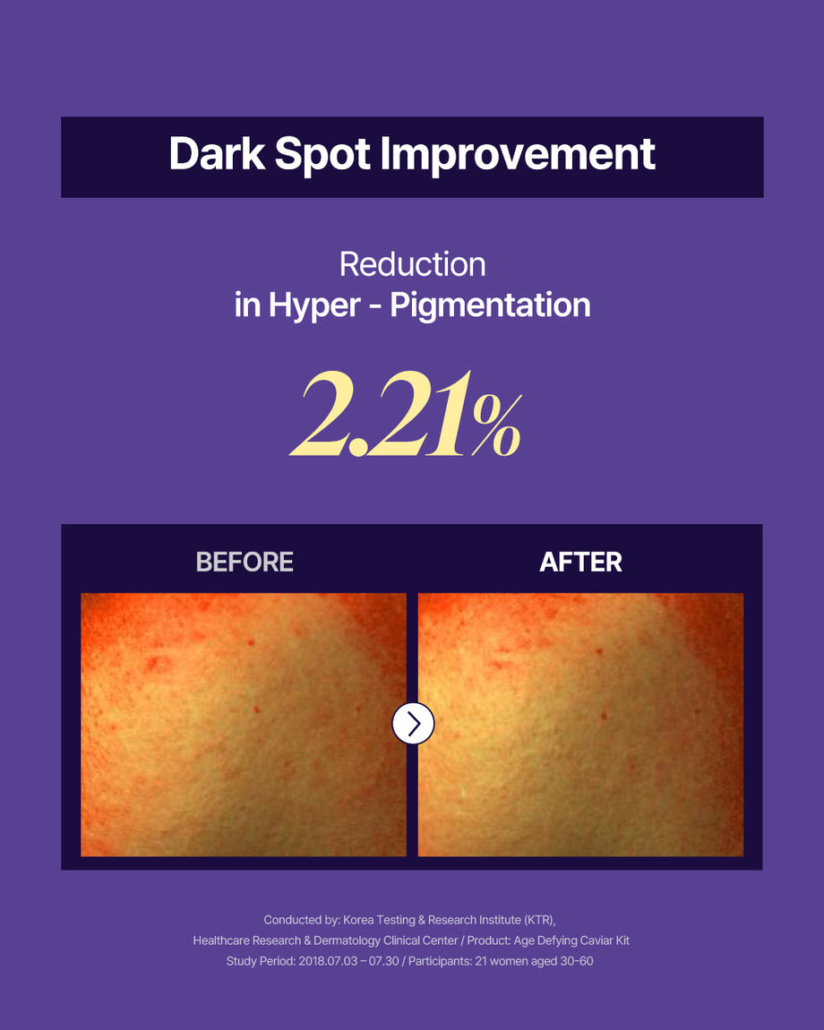 ☆オキシジェンシューティカルズ　キャビア美容液セット☆ OxygenCeuticals] Age Defying Caviar Kit - Premium skincare set for