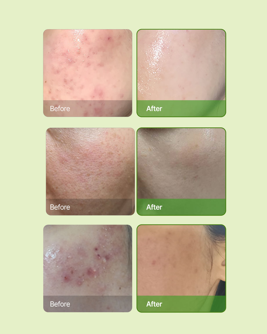 SkinBarrierAtoCream_2_c23d8dea
